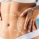 body contouring-liposuction-tummy tuck