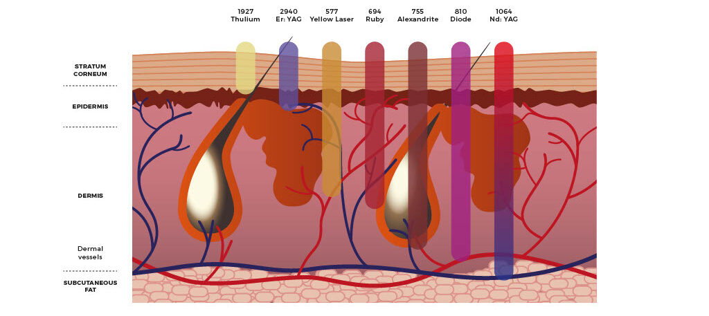 different laser wavelength